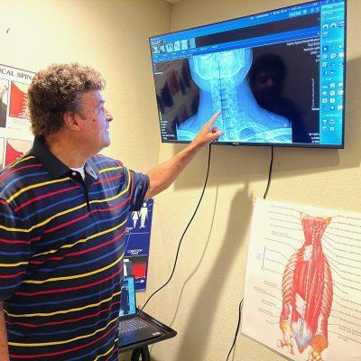 X-Rays Finding relief from headaches with chiropractic care | alpine spinal rehab |